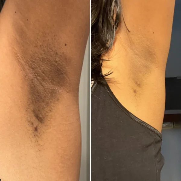 Skin Deep Serum Deodorant