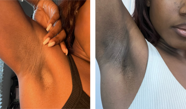 Picture1 Skin Deep Underarm Serum